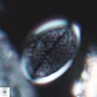Arkhangelskiella specillata LN 18970