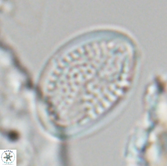 Arkhangelskiella specillata LN 18972