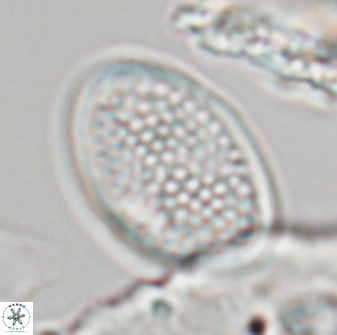Arkhangelskiella specillata LN 18974