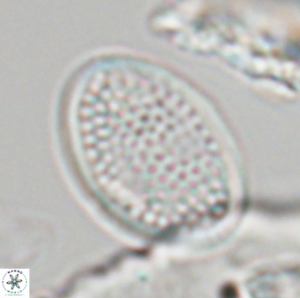 Arkhangelskiella specillata LN 18975