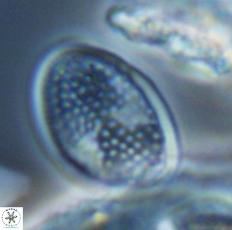 Arkhangelskiella specillata LN 18976