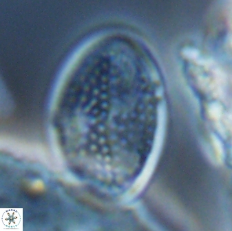 Arkhangelskiella specillata LN 18977