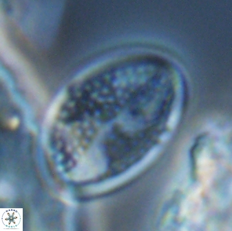 Arkhangelskiella specillata LN 18978