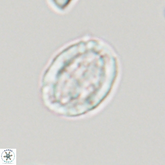 Arkhangelskiella umbracrucis ML 13553
