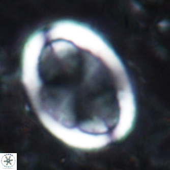 Arkhangelskiella umbracrucis 1657