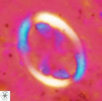 Arkhangelskiella umbracrucis 1658