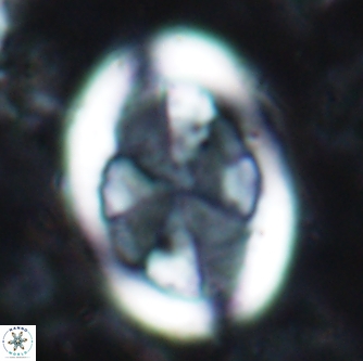 Arkhangelskiella umbracrucis 1660