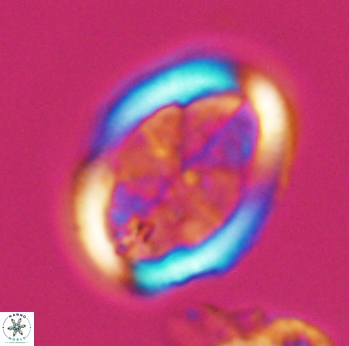 Arkhangelskiella umbracrucis 9799