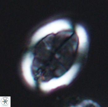 Arkhangelskiella umbracrucis 9800