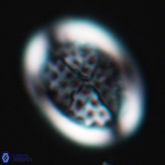 Arkhangeslkiella specillata LM 17758