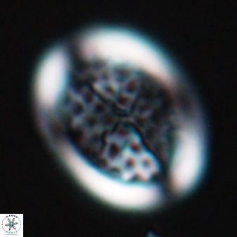Arkhangeslkiella specillata LM 17758