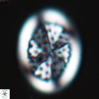 Arkhangeslkiella specillata LM 17760