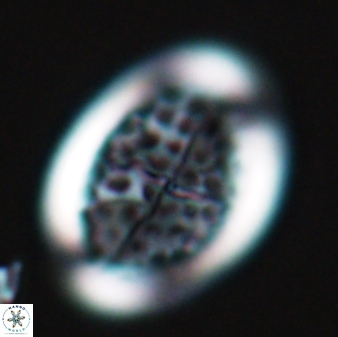 Arkhangeslkiella specillata LM 17762