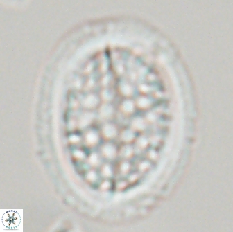 Arkhangeslkiella specillata LM 17764