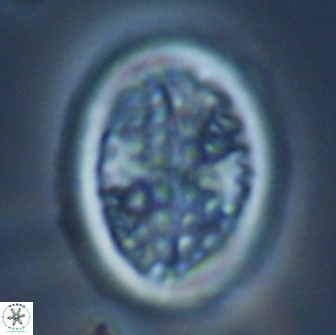 Arkhangeslkiella specillata LM 17765