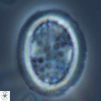 Arkhangeslkiella specillata LM 17766