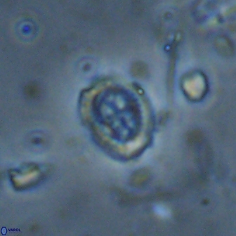 Ataktolithos kystraensis 14701