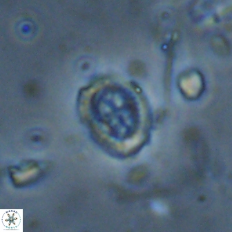 Ataktolithos kystraensis 14701