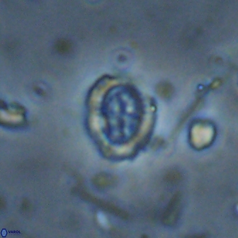 Ataktolithos kystraensis 14702