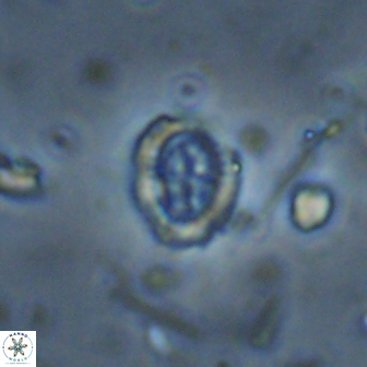 Ataktolithos kystraensis 14702