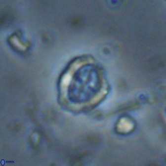 Ataktolithos kystraensis 14703