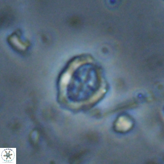 Ataktolithos kystraensis 14703