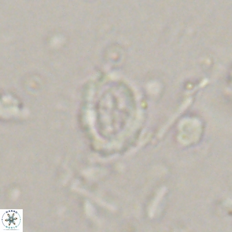 Ataktolithos kystraensis 14704