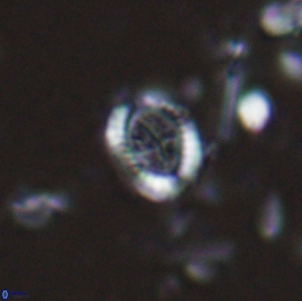 Ataktolithos kystraensis 14705