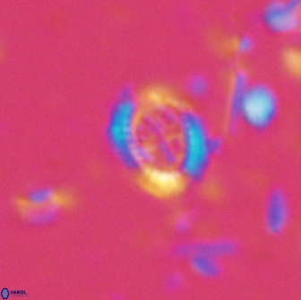 Ataktolithos kystraensis 14706