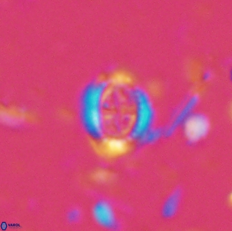 Ataktolithos kystraensis 14707