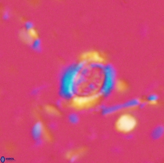 Ataktolithos kystraensis 14710