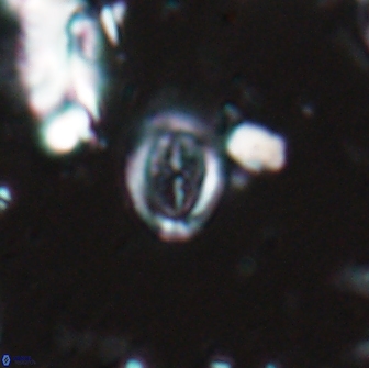 Ataktolithos kystraensis 17236