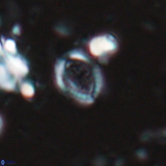 Ataktolithos kystraensis 17238