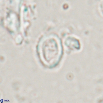 Ataktolithos kystraensis 17243