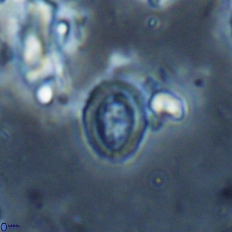 Ataktolithos kystraensis 17244