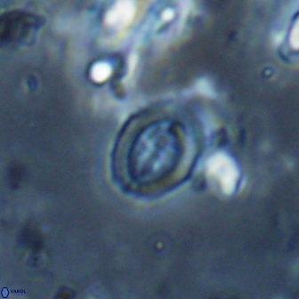 Ataktolithos kystraensis 17246