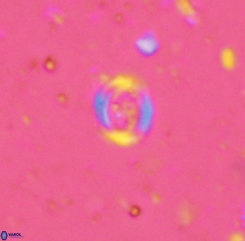 Ataktolithos kystraensis 2287