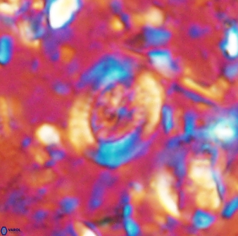 Ataktolithos multicavus 14040