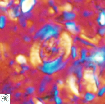 Ataktolithos multicavus 14040