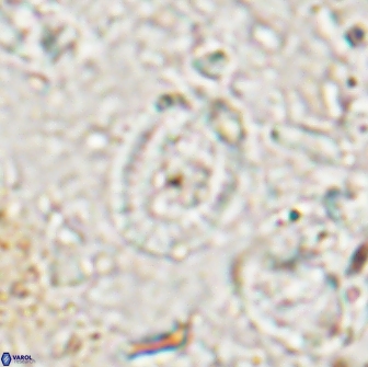 Ataktolithos multicavus 14041