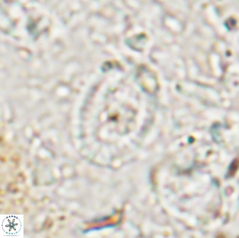 Ataktolithos multicavus 14041