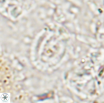 Ataktolithos multicavus 14042