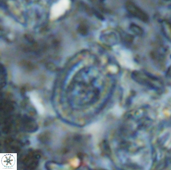 Ataktolithos multicavus 14044