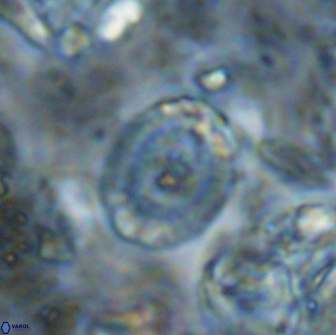 Ataktolithos multicavus 14045