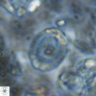 Ataktolithos multicavus 14045