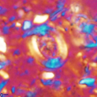 Ataktolithos multicavus 14036