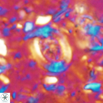 Ataktolithos multicavus 14036