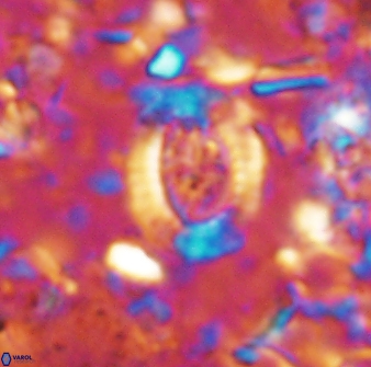 Ataktolithos multicavus 14037