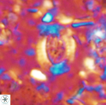 Ataktolithos multicavus 14037