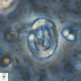 Ataktolithos multicavus 14142